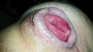 Little compilation of my pumped prolapse ! Close-up